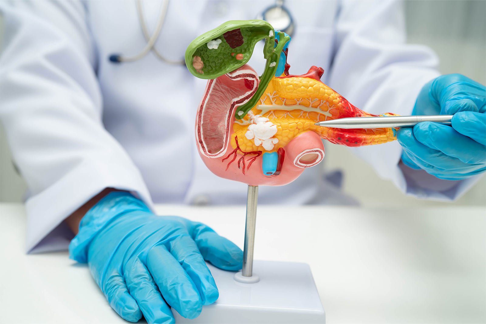 dr-anand-vijai-pancreatic-cancer